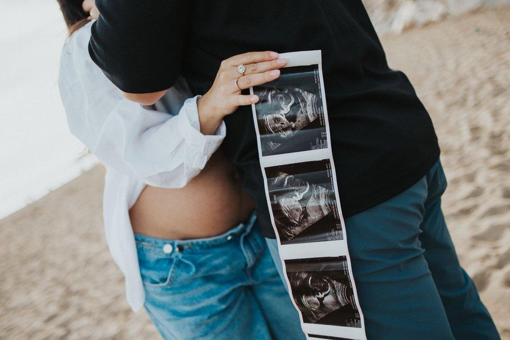 recomment-pack-image-0